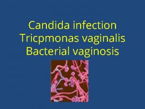 Candida infection Tricpmonas vaginalis Bacterial vaginosis Type of