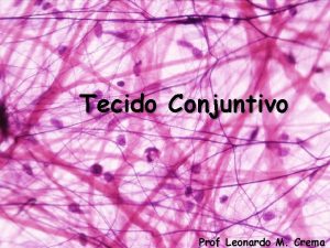 Tecido Conjuntivo Prof Leonardo M Crema Variedades de