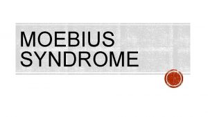 MOEBIUS SYNDROME WHAT IS MOEBIUS SYNDROME Moebius syndrome