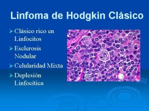 Linfoma de Hodgkin Clsico Clsico rico en Linfocitos