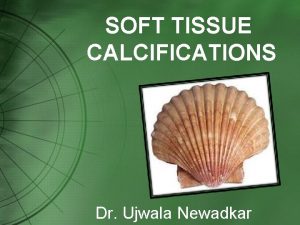 SOFT TISSUE CALCIFICATIONS Dr Ujwala Newadkar Calcified Waterfall