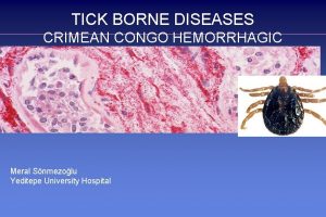 TICK BORNE DISEASES CRIMEAN CONGO HEMORRHAGIC FEVER Meral