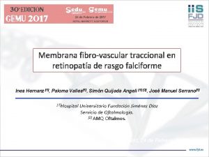 Membrana fibrovascular traccional en retinopata de rasgo falciforme