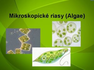 Mikroskopick riasy Algae spolu s jednobunkovmi ivonymi prvokmi