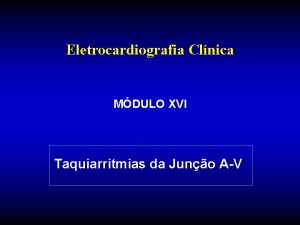Eletrocardiografia Clnica MDULO XVI Taquiarritmias da Juno AV