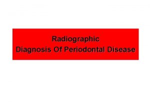 Radiographic Diagnosis Of Periodontal Disease l Why Imaging