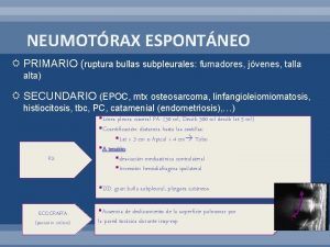 NEUMOTRAX ESPONTNEO PRIMARIO ruptura bullas subpleurales fumadores jvenes