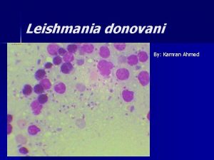Leishmania donovani By Kamran Ahmed Introduction n n