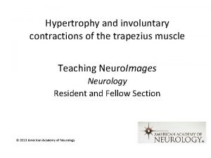 Trapezius hypertrophy