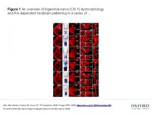 Figure 1 An overview of trigeminal nerve CN