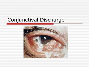 Conjunctival Discharge Conjunctivitis Inflammation o Erythema o Several