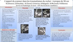 Fracture longitudinale du rocher