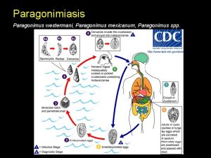 Paragonimiasis Paragonimus westermani Paragonimus mexicanum Paragonimus spp Huevo