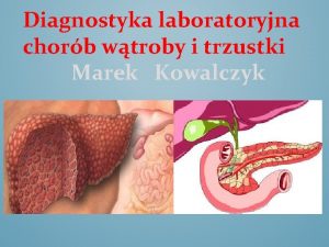 Diagnostyka laboratoryjna chorb wtroby i trzustki Marek Kowalczyk
