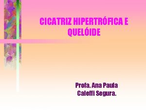 CICATRIZ HIPERTRFICA E QUELIDE Profa Ana Paula Caleffi