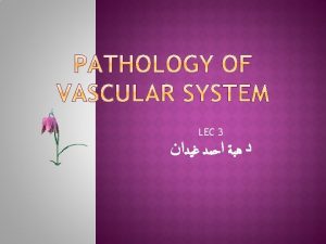 Temporal arteritis