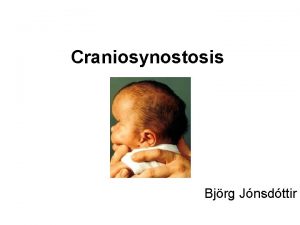 Craniosynostosis Bjrg Jnsdttir Anatma hfubeina 7 einstk bein