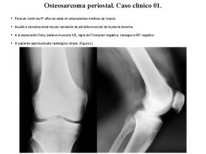 Osteosarcoma periostal Caso clnico 01 Paciente varn de