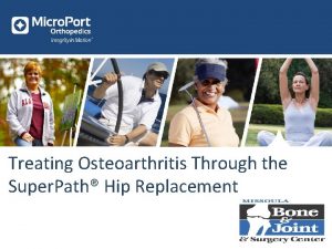 Treating Osteoarthritis Through the Super Path Hip Replacement