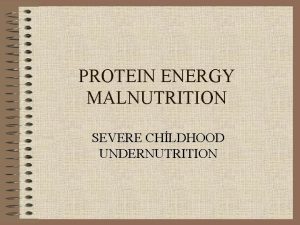 PROTEIN ENERGY MALNUTRITION SEVERE CHLDHOOD UNDERNUTRITION PEMSCU Most