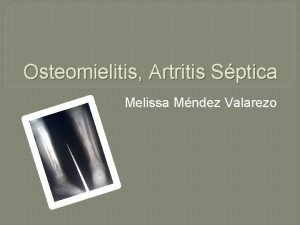 Osteomielitis aguda subaguda y cronica