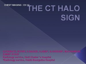 CHEST IMAGING CH 12 THE CT HALO SIGN