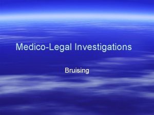 MedicoLegal Investigations Bruising What is a Contusion Bleeding