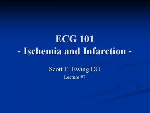 ECG 101 Ischemia and Infarction Scott E Ewing