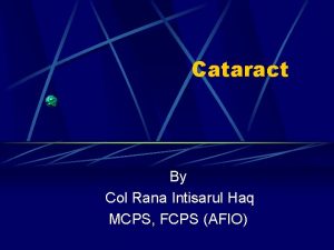 Cataract By Col Rana Intisarul Haq MCPS FCPS