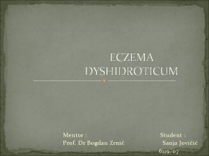Eczema dyshidroticum