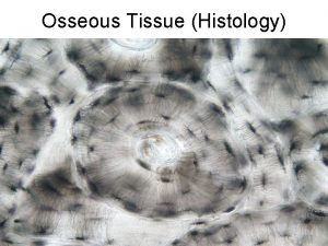 Osseous Tissue Histology Review Bone is a type