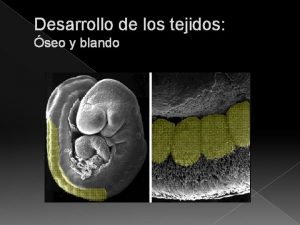 Esclerotomos occipitales Esclerotomos occipitales