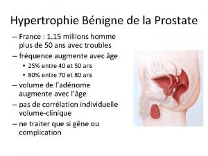 Hypertrophie Bnigne de la Prostate France 1 15