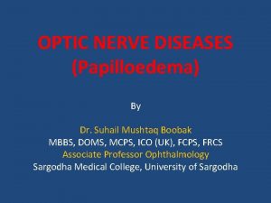 OPTIC NERVE DISEASES Papilloedema By Dr Suhail Mushtaq
