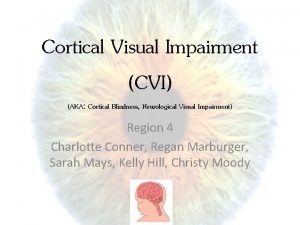 Cortical Visual Impairment CVI AKA Cortical Blindness Neurological