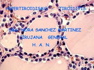 HIPERTIROIDISMO TIROIDITIS DRA NORA SANCHEZ MARTINEZ X2 Tiroides