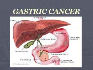 GASTRIC CANCER Decreases in gastric cancer have been