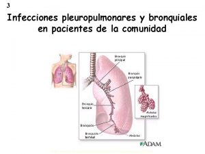 3 Infecciones pleuropulmonares y bronquiales en pacientes de