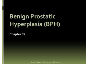 Benign Prostatic Hyperplasia BPH Chapter 55 Copyright 2014
