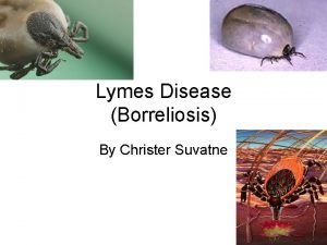 Lymes Disease Borreliosis By Christer Suvatne Introduction Spread