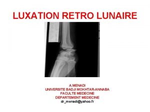 Luxation retro lunaire