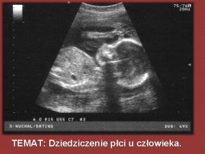 Cechy sprzężone z płcią to cechy niedotyczące płci