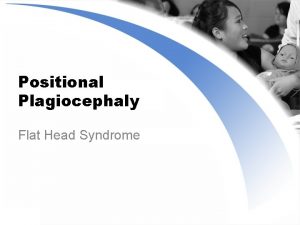 Positional Plagiocephaly Flat Head Syndrome Positional Plagiocephaly Also