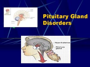 Pituitary Gland Disorders Pituitary Gland The pituitary is