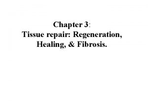 Chapter 3 Tissue repair Regeneration Healing Fibrosis Critical