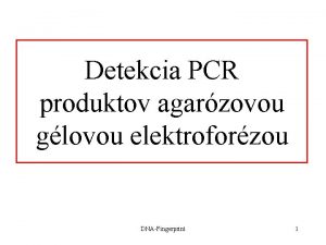 Detekcia PCR produktov agarzovou glovou elektroforzou DNAFingerprint 1