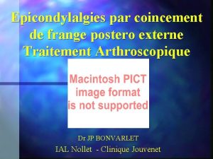 Epicondylalgies par coincement de frange postero externe Traitement