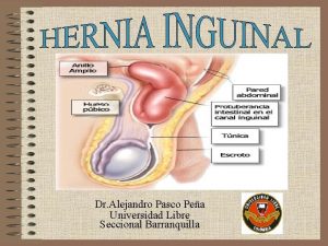 Fisiopatologia hernia inguinal