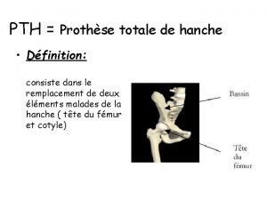 PTH Prothse totale de hanche Dfinition consiste dans