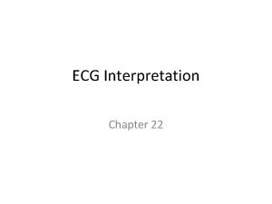 ECG Interpretation Chapter 22 ECG Interpretation 1 Rate